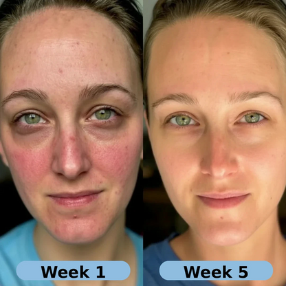 💥Korean Collagen Serum for Mature Skin