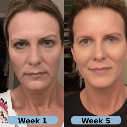 💥Korean Collagen Serum for Mature Skin