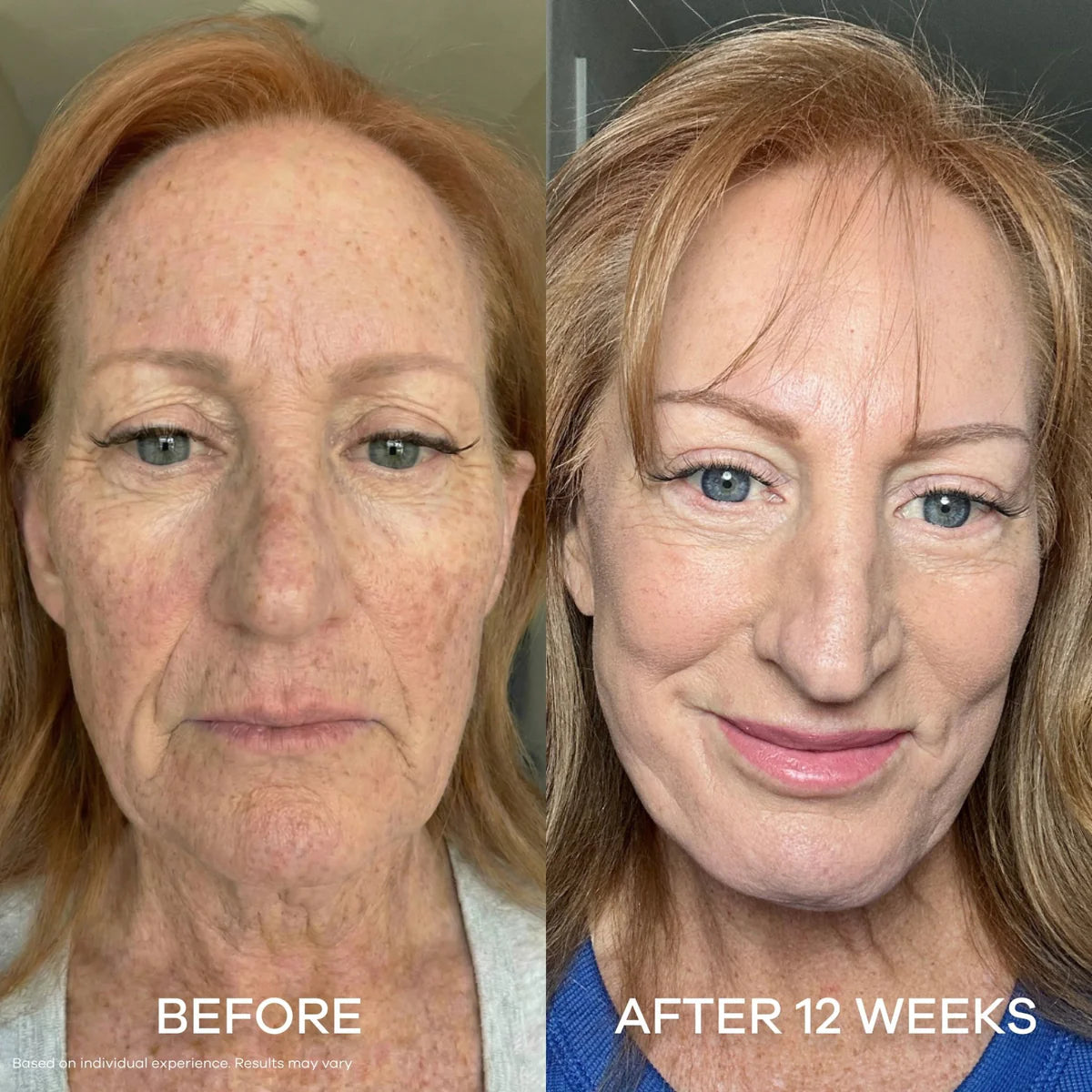 💥GHK-Cu Overnight Wrapping Mask